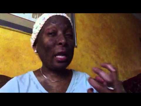 how to treat oral gvhd