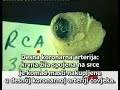 Pojedi ovo 1/3