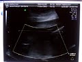 19 weeks pregnant