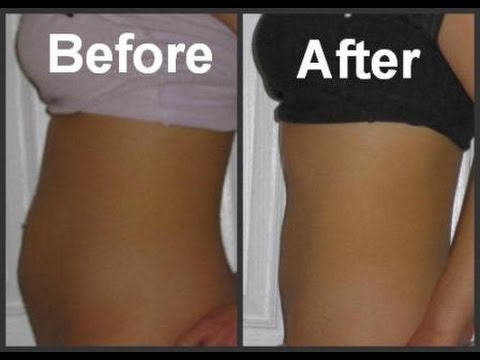 how to beat bloating