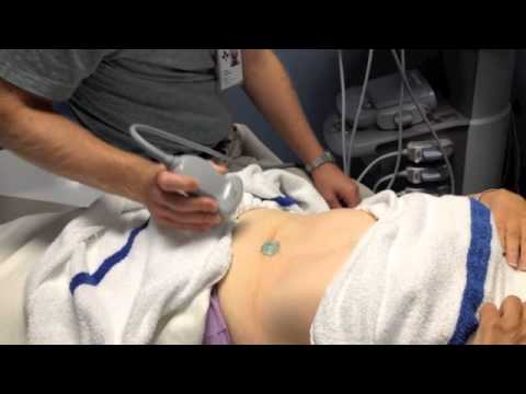 how to locate the aorta