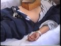 Moxibustion und Akupunktur in Beijing, 1983