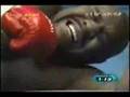 bob sapp broken cheek bone