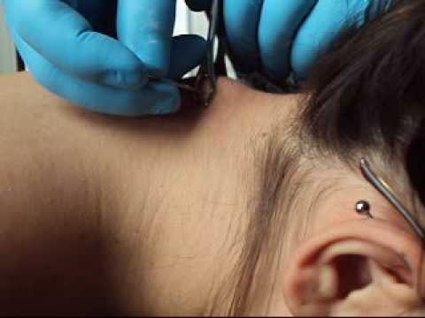 Legacytattooman; Tags: Legacy Tattoo surface piercings cottonwood