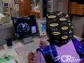 Radiofrequency Ablation of a Kidney Tumor