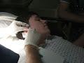 Staph Infection Staph Infection