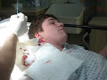 Staph Infection