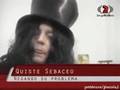 Peter Capusotto-quiste sebaceo