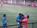 Varoli 5-2