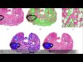 Dr. Anant Madabhushi - Development of mutli-modal prostate cancer screening technologies
