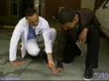 david-blaine-arm-twi