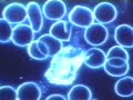 Earth's Tiniest Living Organisms: Somatids (Identify: Friend or Foe?)  Nutritional Medicine ADHD