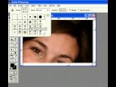 Photoshop Tutorial on removing blemishes like zits or scars Photoshop Tutorial on removing blemishes like zits or scars