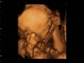 4-D Yawning Baby at 24 weeks