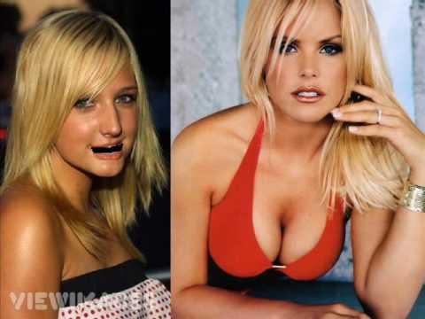the simpson twins