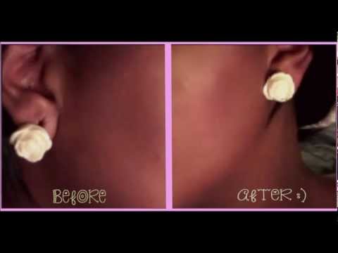 how to close my gauged ears