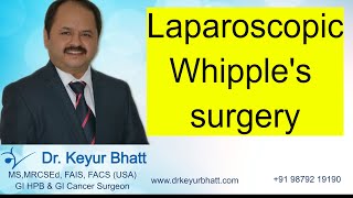 Lap Whipple's surgery