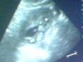 videos de baby @ 3 mos