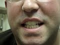 Thumbnail #2