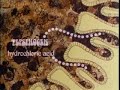 Digestive System (2nd Ed., Rev.) (Clip)