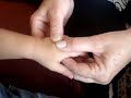 Common Flu-Baby Massages (Xiau er tuina massages) Common Flu-Baby Massages (Xiau er tuina massages)