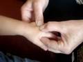Common Flu-Baby Massage (Xiau er tuina massages)  Alternative Therapy: Tui Na, Tuina