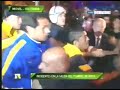 Opstootje levert Boca-spits gebroken vingers op
