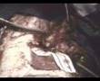 Craniofacial Resection & Reconstruction