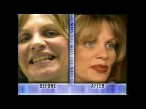 how to whiten porcelain