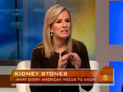 how to reduce kidney stones