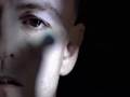 clip video Cirkus Starved