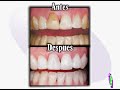 Odontologia Estetica