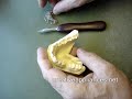 Mandibular Anterior Tooth Moving Appliance Mandibular Anterior Tooth Moving Appliance