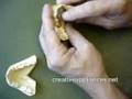 Mandibular Anterior Tooth Moving Appliance