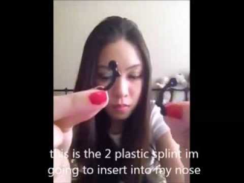 how to define nose naturally