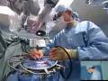NEUROSURGERY-BRAIN TUMOR