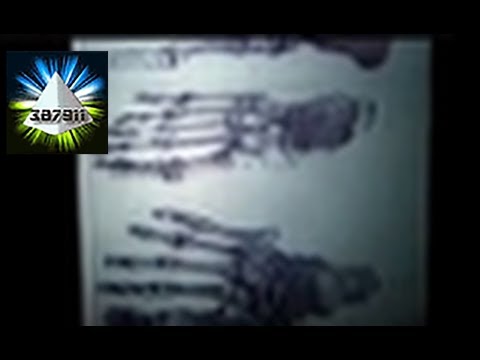 Lloyd Pye ★ Everything You Know Is Wrong Alien Starchild Skull DNA ♦ Ancient Alien Intervention