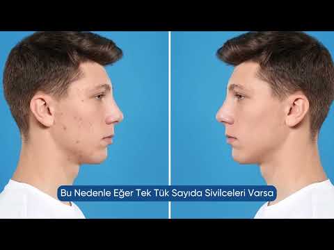  Nursel Dilek Dermatoloji Uzmanı, AKNE, TEDAVİ SÜRECİ VE NEDENLERİ NEDİR ?
