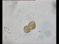 two dinoflagellate gametes merging
