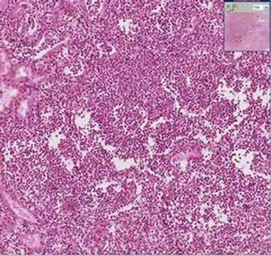 Histopathology Kidney--Acute and ...