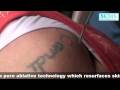 Laser Tattoo Removal on Breast