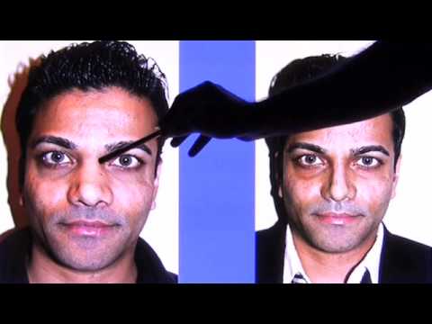 Revision Rhinoplasty NYC performed by Dr. Sam Rizk. Revision Rhinoplasty NYC performed by Dr. Sam Rizk.