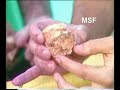 los yacimientos de la sierra de atapuerca 2ª parte