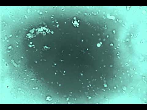Vibrio Fischeri