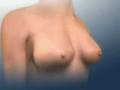 Cosmetic Surgery Abroad www.cosmetic-surgery-poland.org