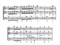 Händel: Carco sempre di gloria, HWV 87 - 1/2 - Lesne