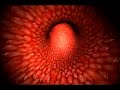 Angina y Enfermedad Coronaria Arterial