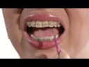 HOW TO FLOSS IN SECONDS  - WITH OR WITHOUT BRACES