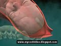 3D Animation Of Childbirth 3D Animation Of Childbirth