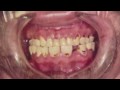 MethMouth (now on iTunes) MethMouth (now on iTunes)